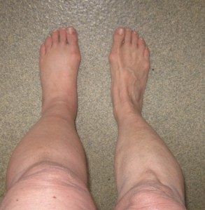 Note especially the difference between left knee and right, and left foot and right.